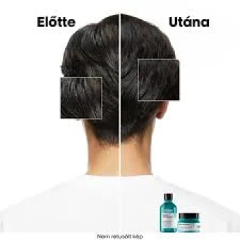 L'Oreal Scalp Advanced Anti-Pelliculaire Dandruff Sampon